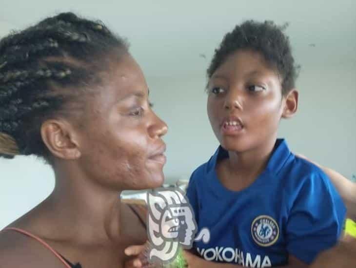 Anne Rose salió de Haití para atender la hidrocefalia de su hijo