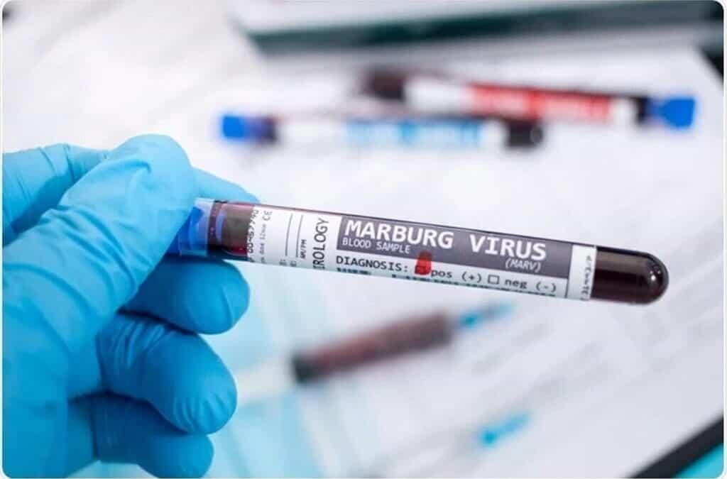 Detectan dos casos de Marburgo, enfermedad similar al ébola, en Ghana