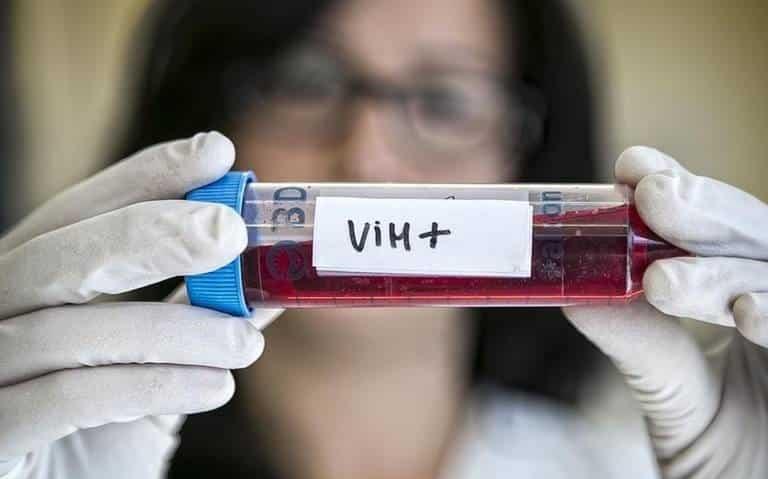 Veracruz, segundo lugar nacional en más casos de VIH